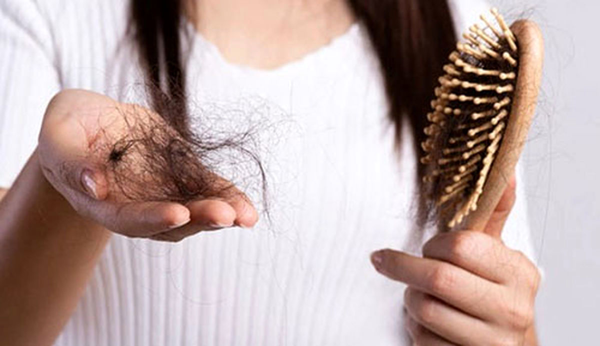مهمترین علل ریزش مو در زنان مشخص شد | احتمال ابتلا به دیابت