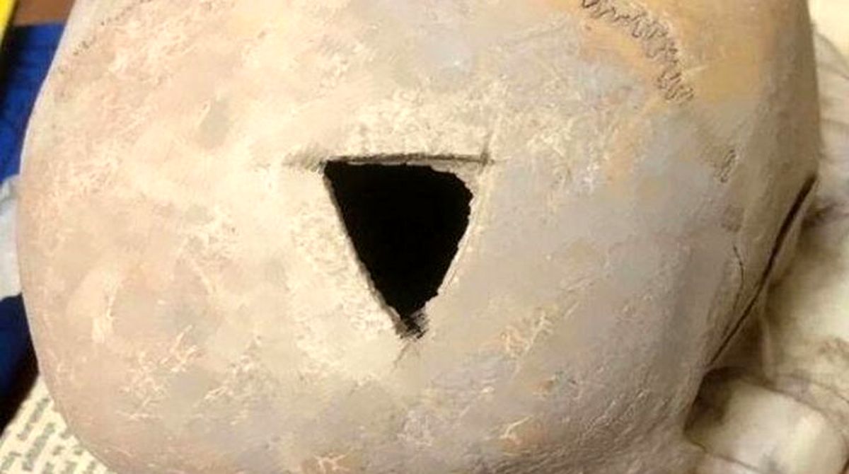 پیدا شدن جمجمه انسان ۳۲۰۰ ساله در وان ترکیه با سوراخی در سر !